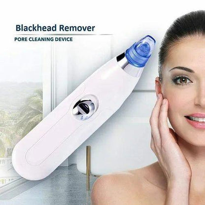 Corden Voss Ultrasonic Facial Pore Cleaner — Blackhead and Dead Skin Remover